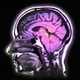 Illustration for article titled Paralyzed Man Speaks Again Using Brain Implant